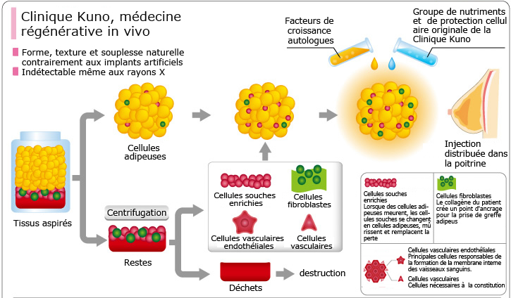 Clinique Kuno, médecine régénérative in vivo