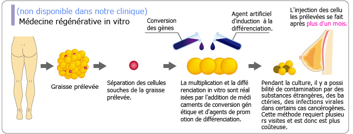 (non disponible dans notre clinique)Médecine régénérative in vitro