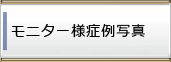 モニター様症例写真