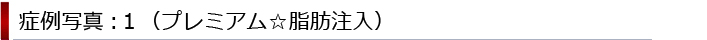 症例写真：１（プレミアム☆脂肪注入）