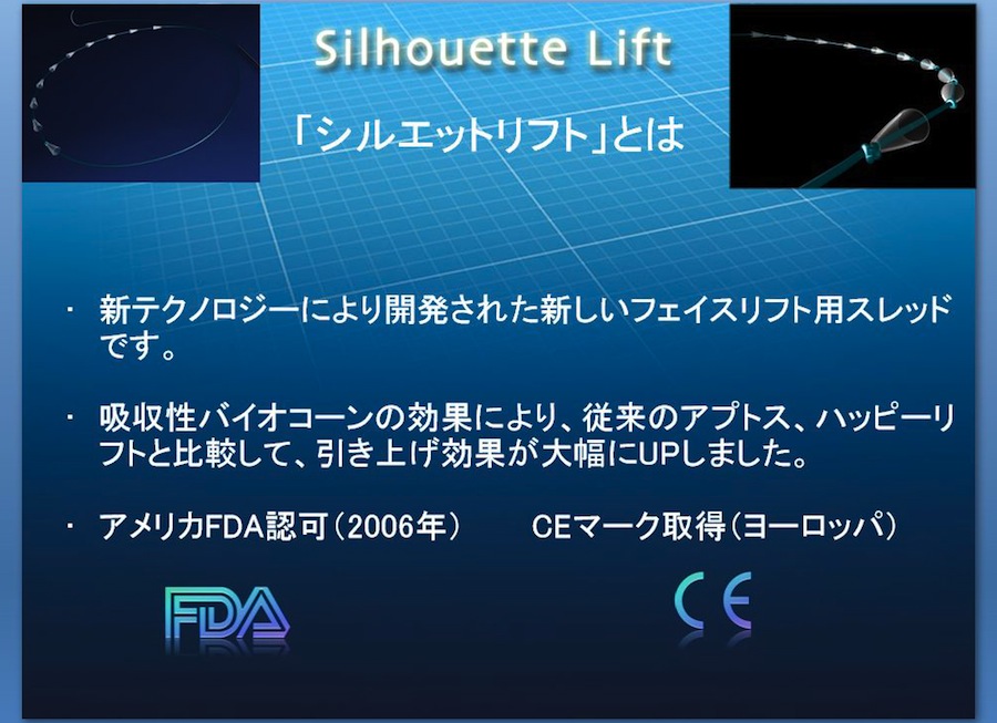 シルエットリフトとは