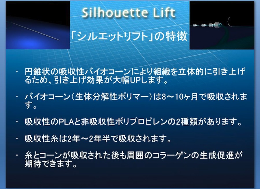 シルエットリフトの特徴