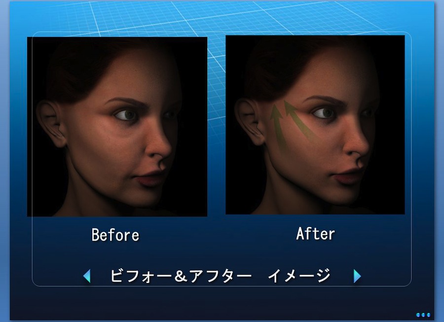 ビフォー＆アフター イメージ
