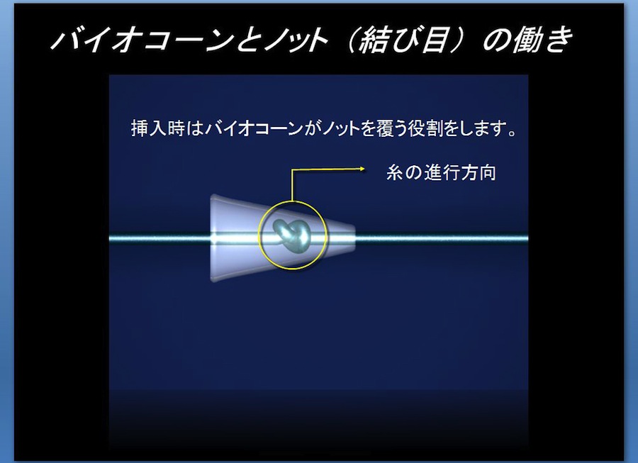 バイオコーンとノット（結び目）の働き