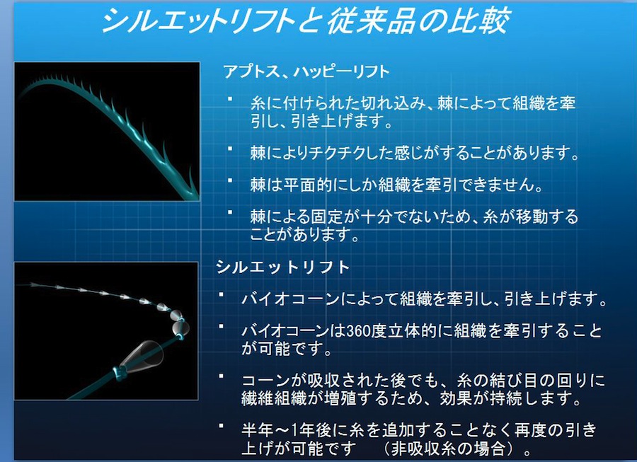 シルエットリフトと従来品の比較