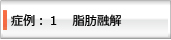 症例：1 脂肪融解