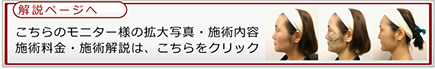 解説ページへ　こちらのモニター様の拡大写真・施術内容　施術料金・施術解説は、こちらをクリック