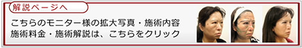 解説ページへ　こちらのモニター様の拡大写真・施術内容　施術料金・施術解説は、こちらをクリック