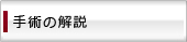 手術の解説
