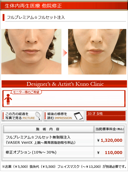 頬の陥没を改善 生体内再生医療