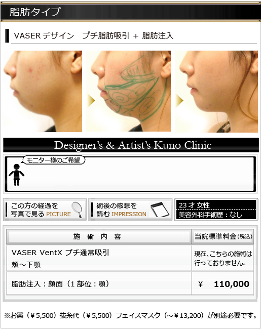 脂肪タイプ
